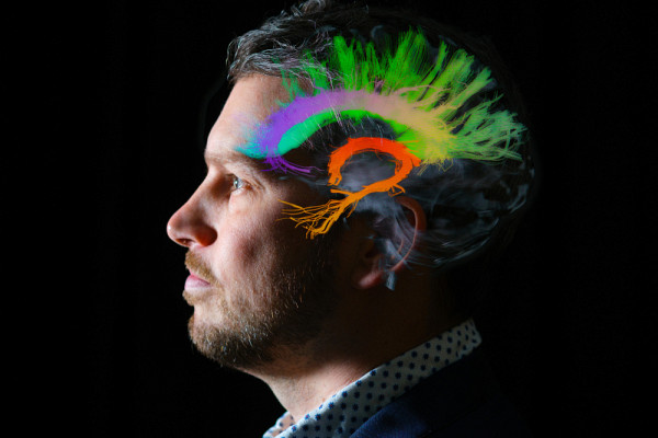 L'objectif de la société savante est d'observer la connectivité du cerveau sous toutes ses couleurs.